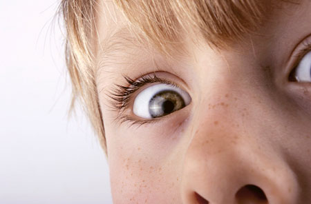 Цифровой ожог Цифровой ожог