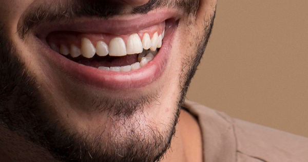 Порадовался за бывшую Порадовался за бывшую