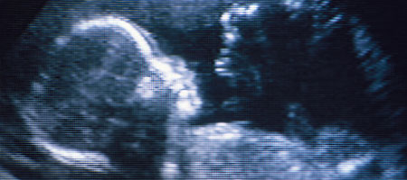 Стресс будущей матери может сказаться на психике малыша Стресс будущей матери может сказаться на психике малыша