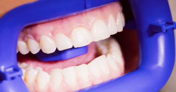 Стоматологам уготован отдельный котёл в аду Стоматологам уготован отдельный котёл в аду